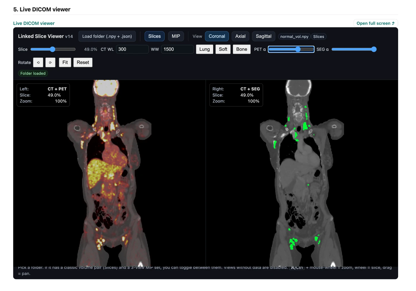 Live linked DICOM viewer from the sample PET/CT report